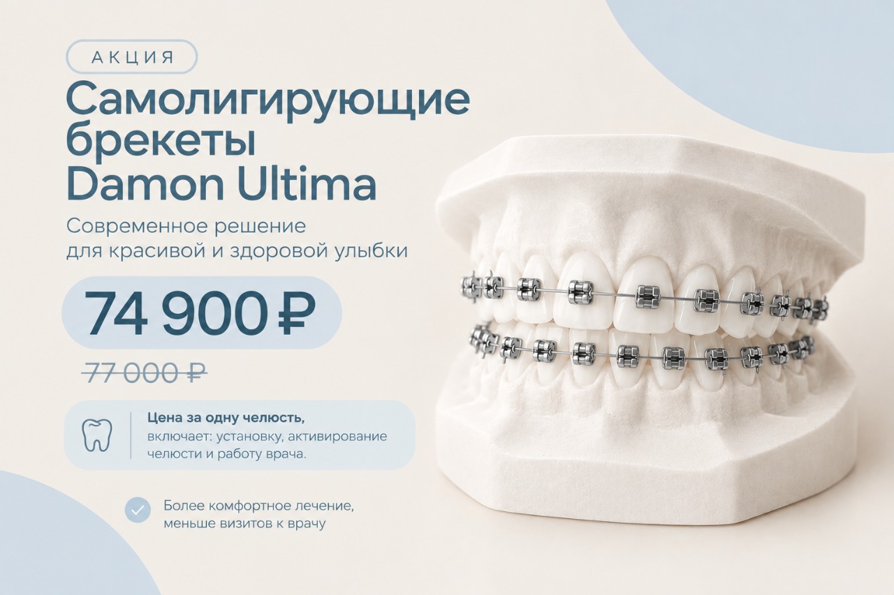 Акция на самолигирующие металлические  брекеты Damon Ultima