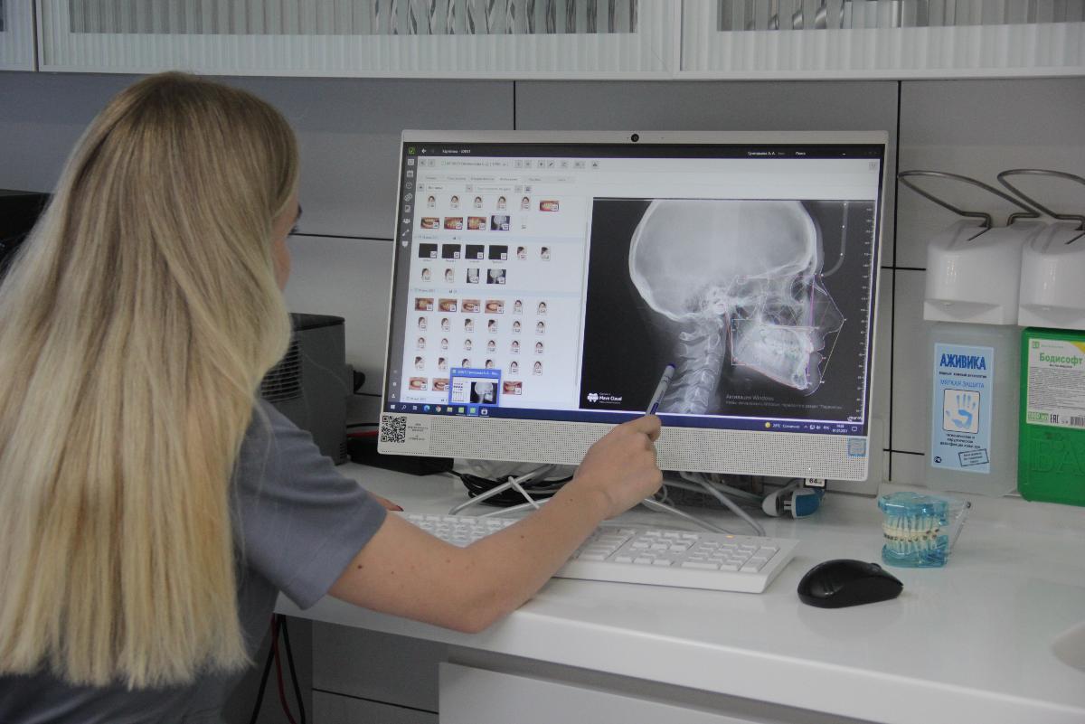 Конусно-лучевая компьютерная томография (КЛКТ, КТ, 3D-снимок)
