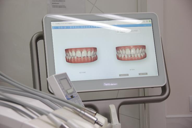 Группа клиник “Чистое Дыхание” полностью перешла в эру цифровой стоматологии