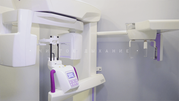 Конусно-лучевая компьютерная томография (КЛКТ, КТ, 3D-снимок)