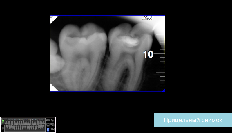 3Д снимок зубов в стоматологии: что показывает, как делают